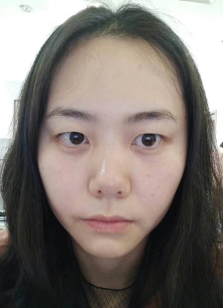 年轻人是会长眼袋的?那你选择怎么解决?567 年轻人是会长眼袋的?那你选择怎么解决?567
