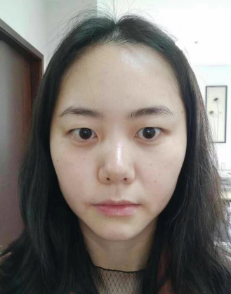 年轻人是会长眼袋的?那你选择怎么解决?567 年轻人是会长眼袋的?那你选择怎么解决?567