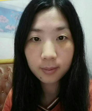 去眼袋手术