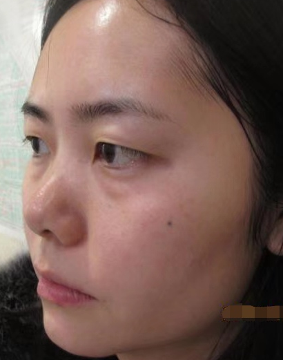 年轻人是会长眼袋的?那你选择怎么解决?567 年轻人是会长眼袋的?那你选择怎么解决?567