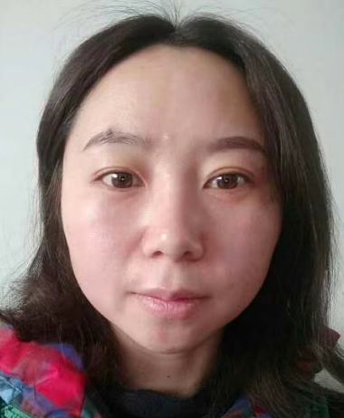 去眼袋手术