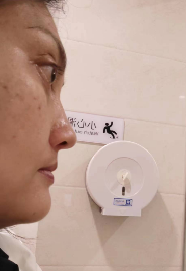 去眼袋手术