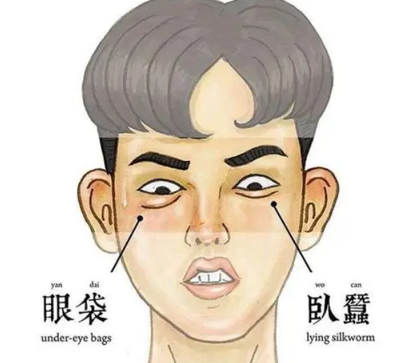 去眼袋手术
