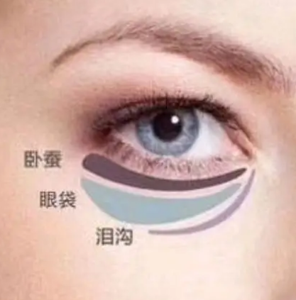 去眼袋手术