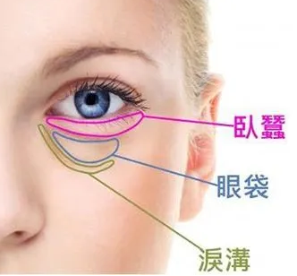 去眼袋手术