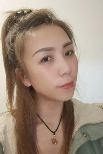 去眼袋手术