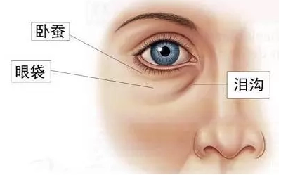 去眼袋手术