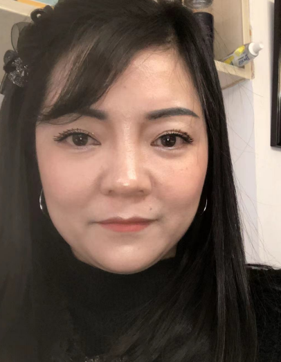 如何让眼袋消除?如何安全去眼袋?969 如何让眼袋消除?如何安全去眼袋?969
