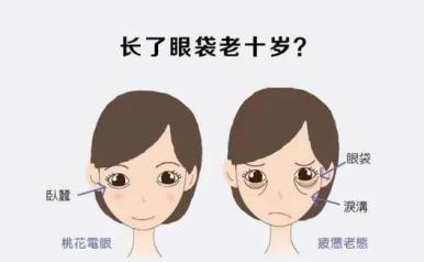 去眼袋手术后
