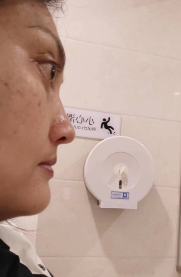 去眼袋手术