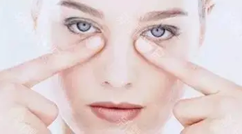做眼袋如何恢复?想效果好怎么选择方法?968 做眼袋如何恢复?想效果好怎么选择方法?968