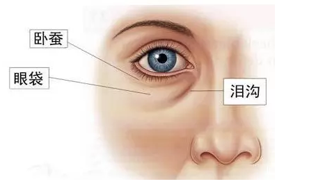 去眼袋手术