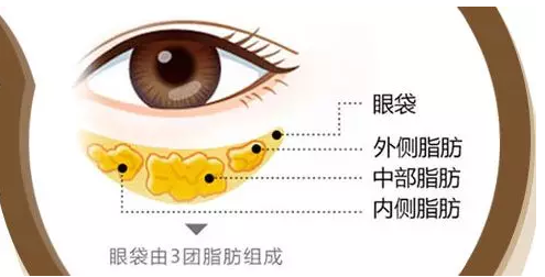 去眼袋手术