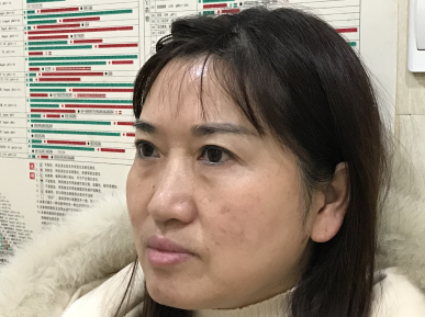 去眼袋手术