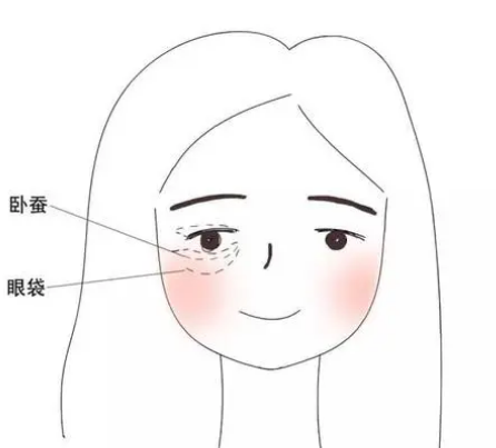 去眼袋手术