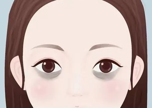 去眼袋手术