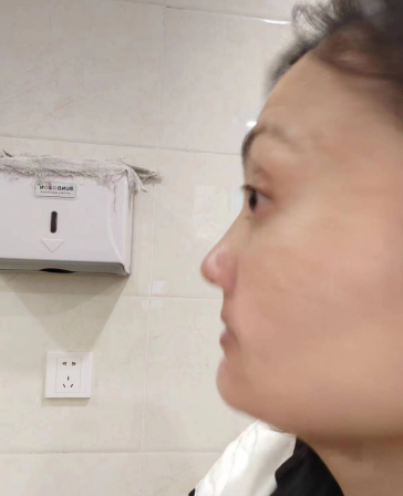 去眼袋手术