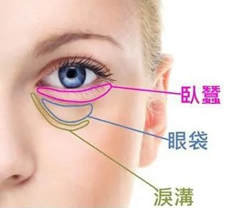去眼袋手术