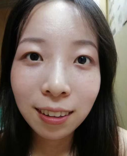 去眼袋手术