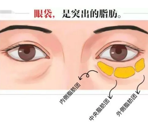 你是如何知道治眼袋的?有人给你推荐吗?169 你是如何知道治眼袋的?有人给你推荐吗?169