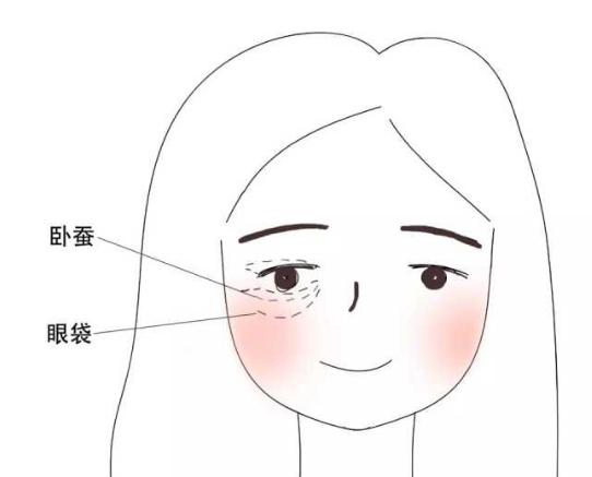 去眼袋手术