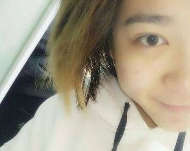 去眼袋手术