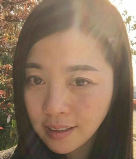 去眼袋手术