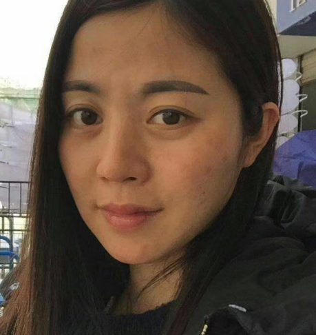 去眼袋手术