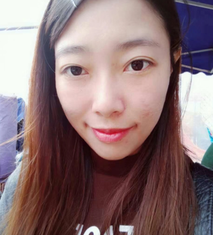 去眼袋手术