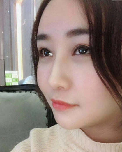 去眼袋手术
