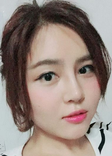 自体脂肪胶填充
