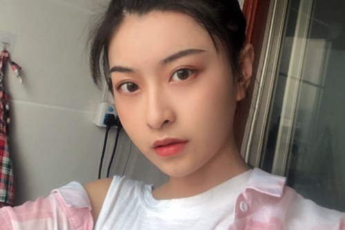 自体脂肪填充
