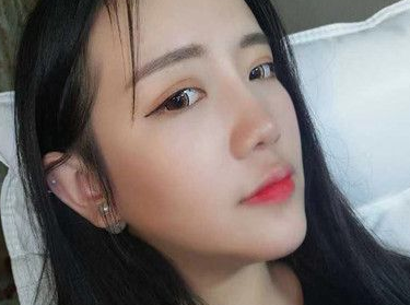 自体脂肪胶填充