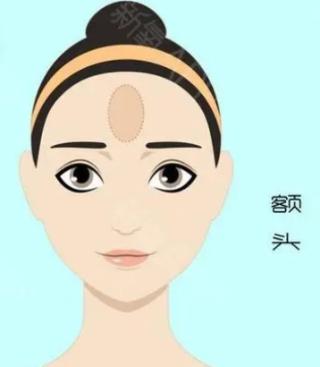 自体脂肪胶填充