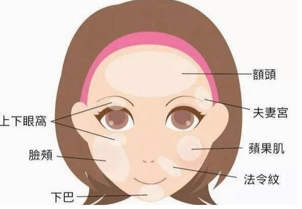自体脂肪胶填充