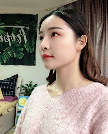 自体脂肪胶填充