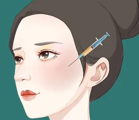 自体脂肪胶填充