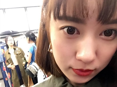 自体脂肪胶填充