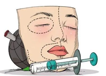 自体脂肪胶填充