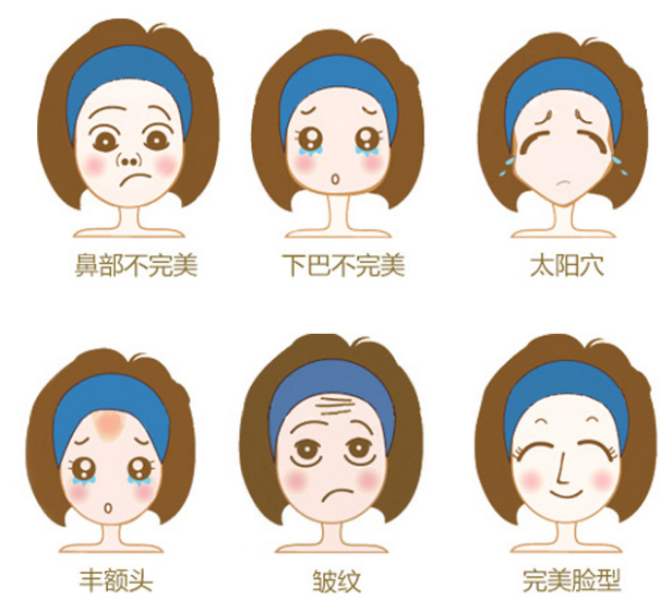 自体脂肪胶填充