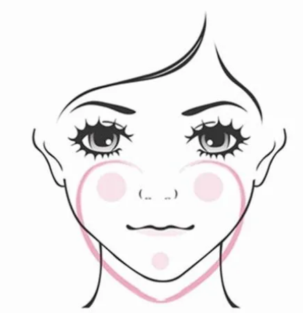 自体脂肪胶填充