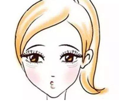 自体脂肪胶填充