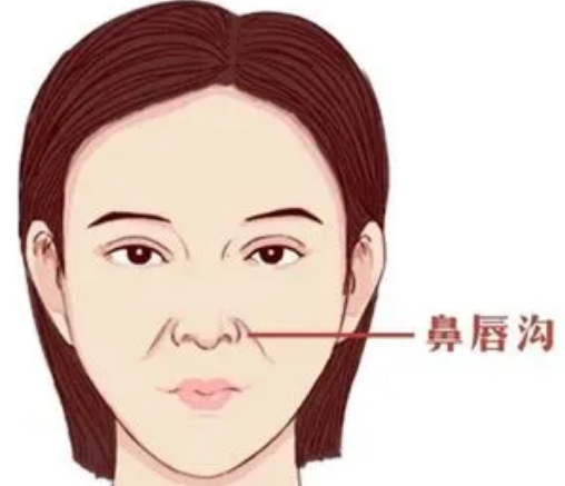 自体脂肪胶填充