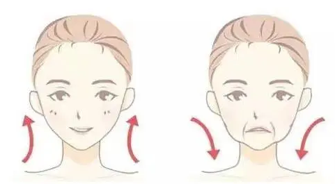 自体脂肪胶填充