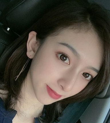 不选玻尿酸用自体脂肪胶填充下巴,效果好吗?111 不选玻尿酸用自体脂肪胶填充下巴,效果好吗?111