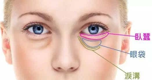 40多岁眼袋很重,还有黑眼圈该如何解决?418 40多岁眼袋很重,还有黑眼圈该如何解决?418