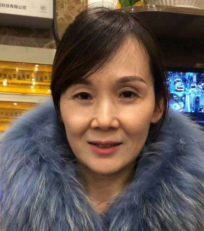 去眼袋手术