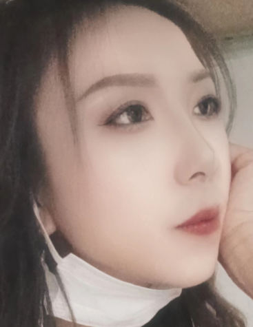 去眼袋手术
