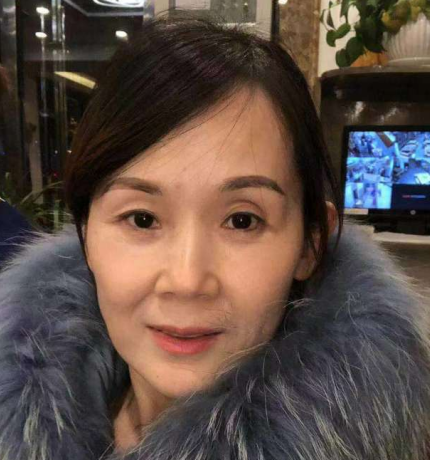 去眼袋手术