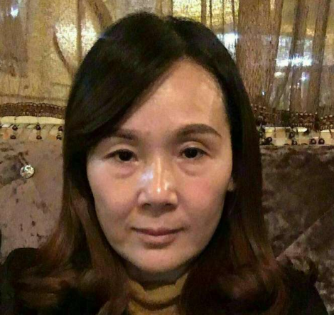 去眼袋手术